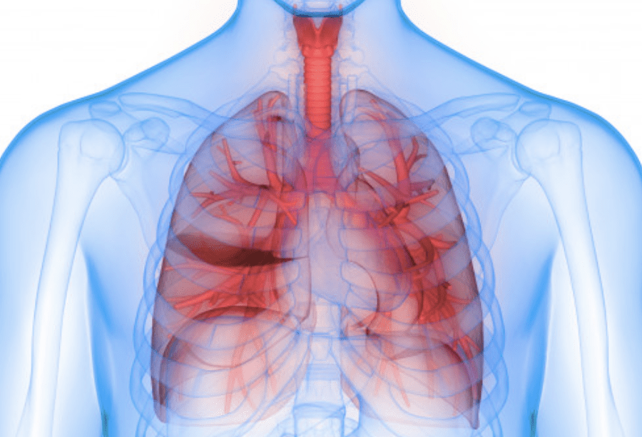THE SERIOUS COMPLICATIONS OF PNEUMONIA YOU SHOULD KNOW