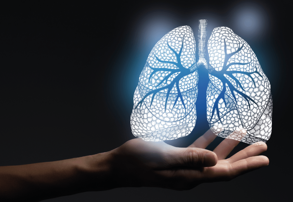 PNEUMONIA: INFLAMMATION OF THE LUNGS