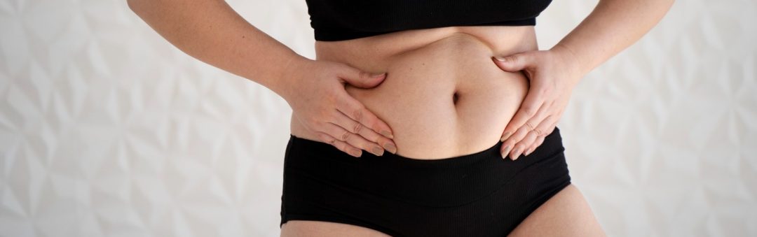 Which Obesity Surgery Should I Choose In Dubai