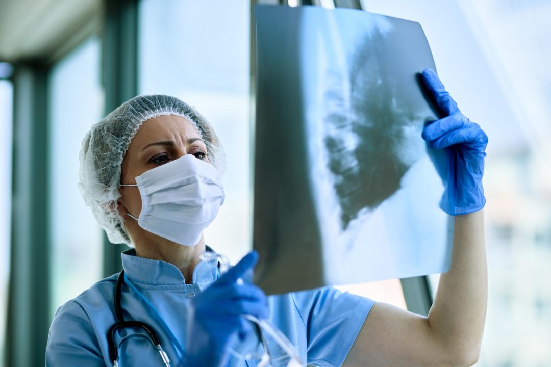 6 Things To Know About Pneumonia