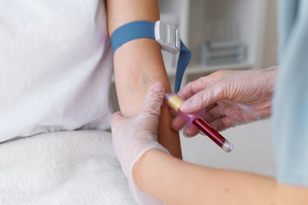 Vitamin D Deficiencies: What To Know