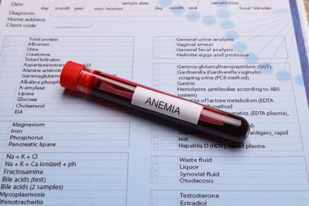 Anemia Causes, Symptoms, Types, Diet and Treatment