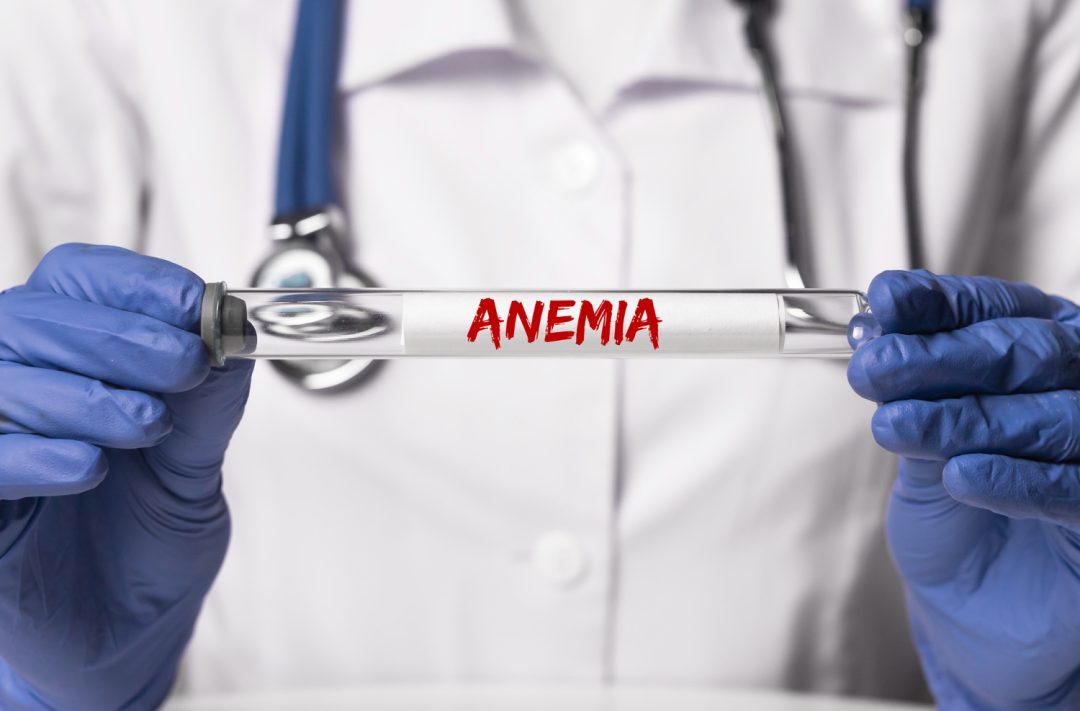 How is Iron-Deficiency Anemia Treated?