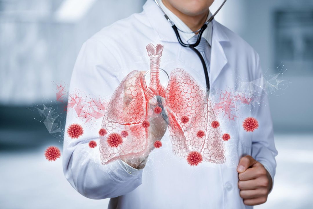 Pneumonia Treatment and Recovery