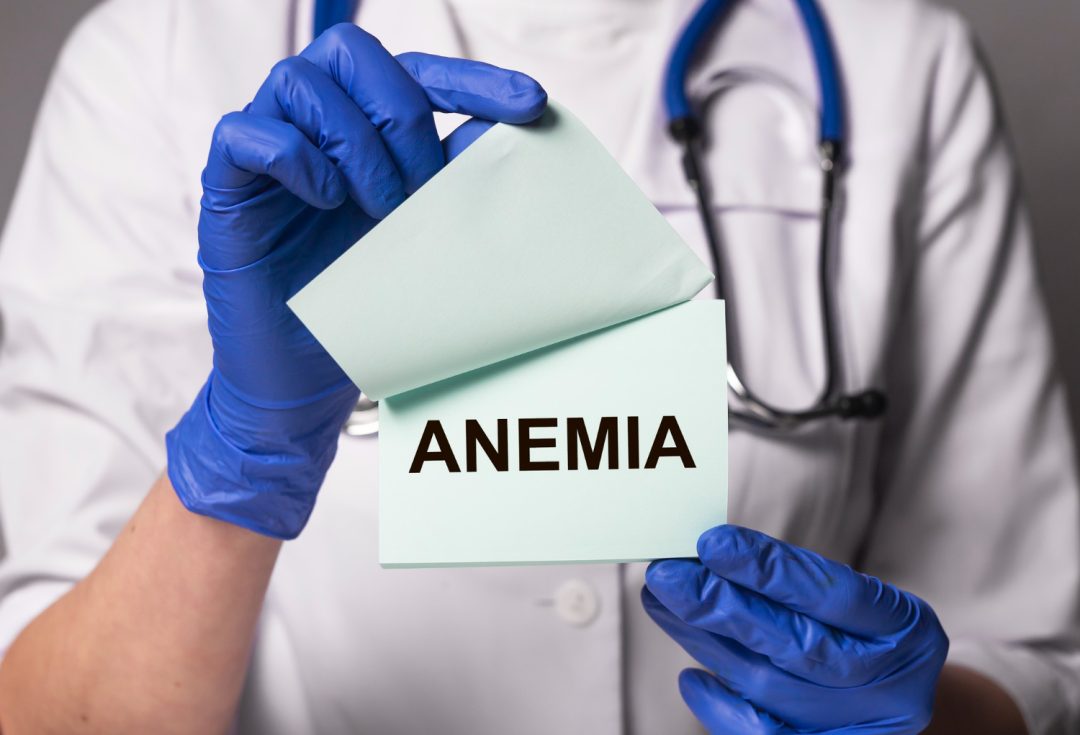 Anemia Powerful Ways to Keep Iron Levels Up