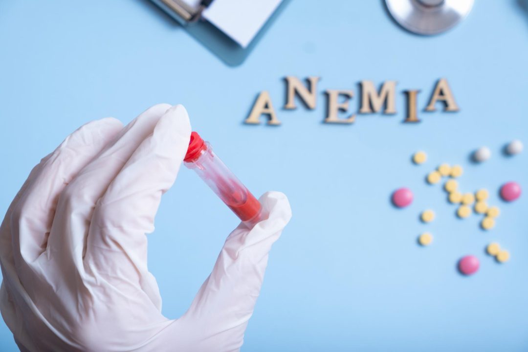 Anemia the Low Hemoglobin A-to-Z Guide From Diagnosis to Treatment to Prevention