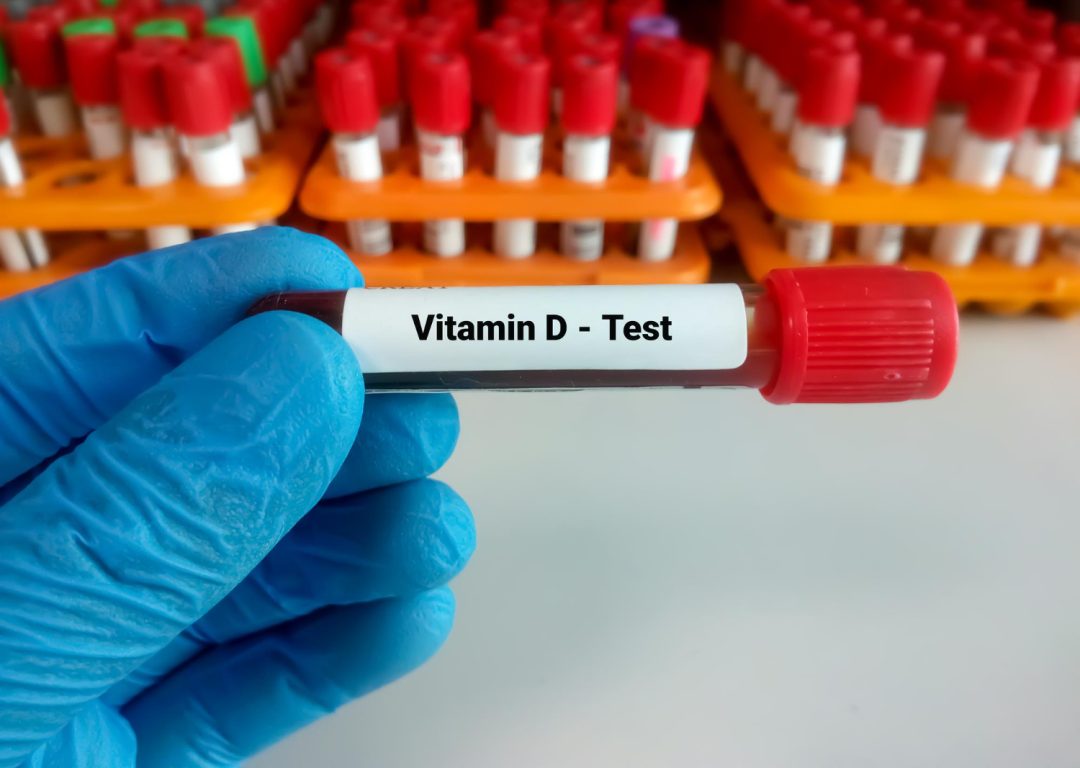 Vitamin D Deficiency Dubai: Symptoms, Tests And Treatment