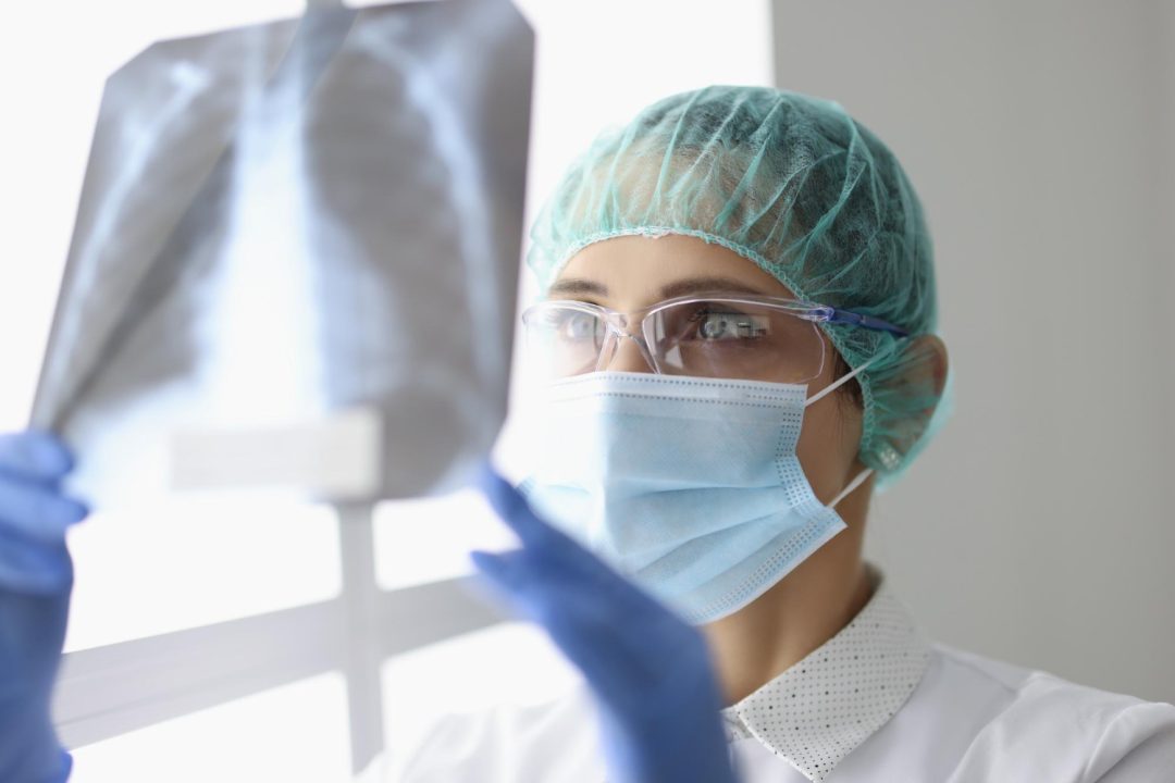 Comprehensive Pneumonia Handbook: Your Ultimate Guide