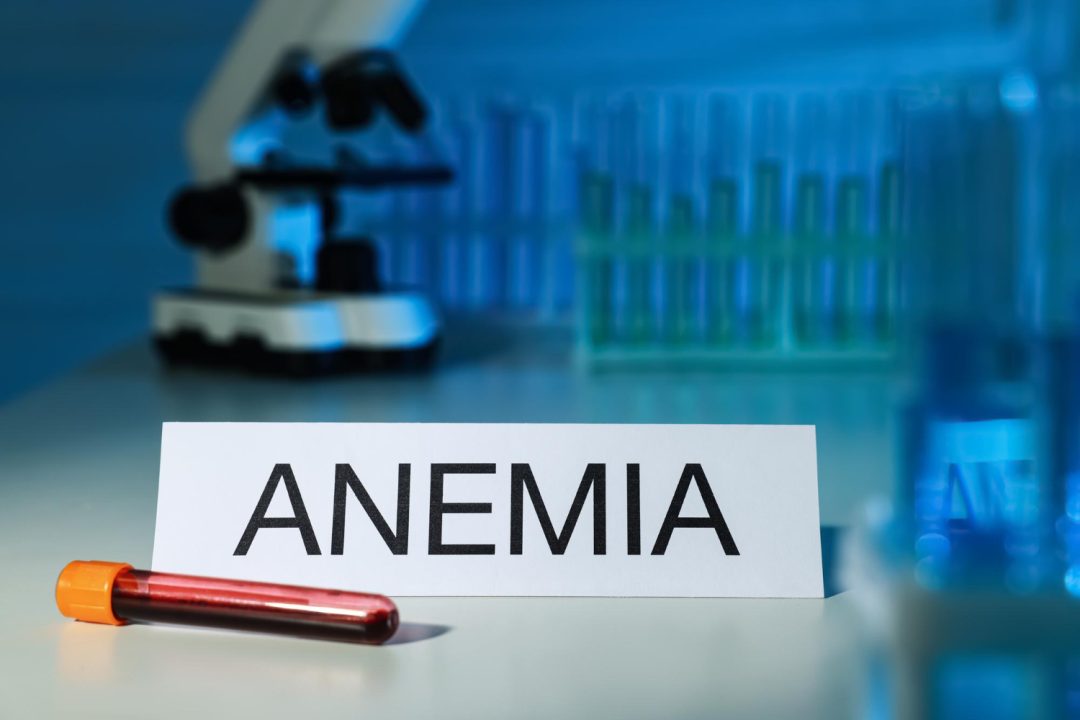 Anemia Symptoms, Causes And Treatment
