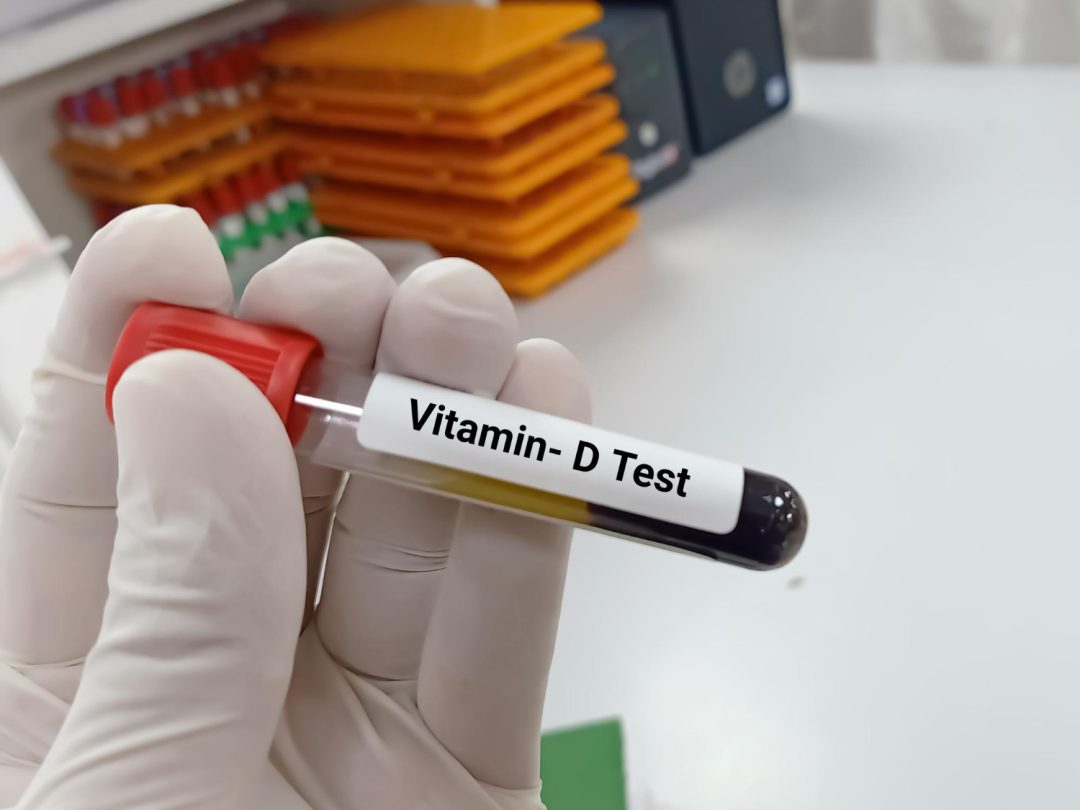 Vitamin D: What Dubai Residents Need to Know